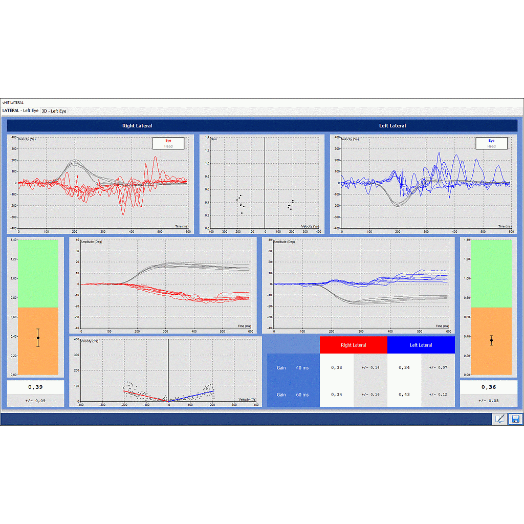 Nystagmography software Disoft II PRO Line : VHIT Lateral Only