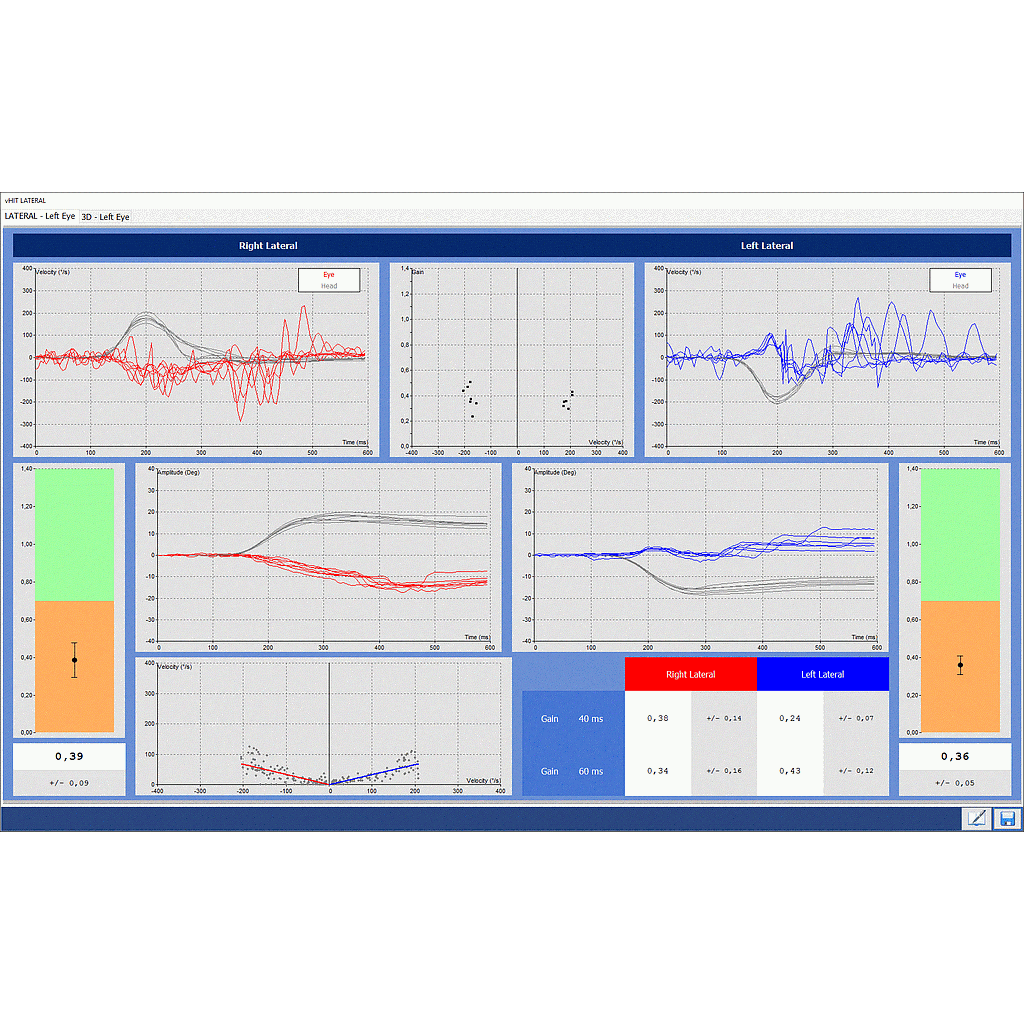 Module Video Head Impulse Test (VHIT), horizontal only, for Headstar