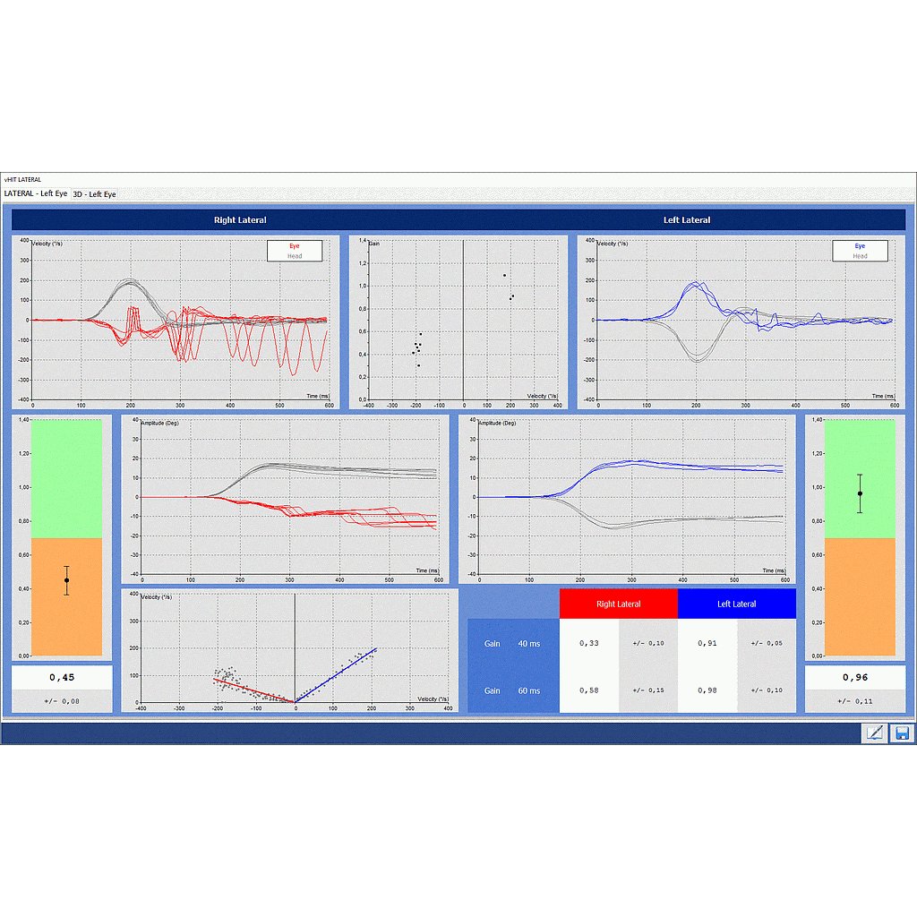 DI 14050X-VHIT : Nystagmography software Disoft II PRO Line : VHIT