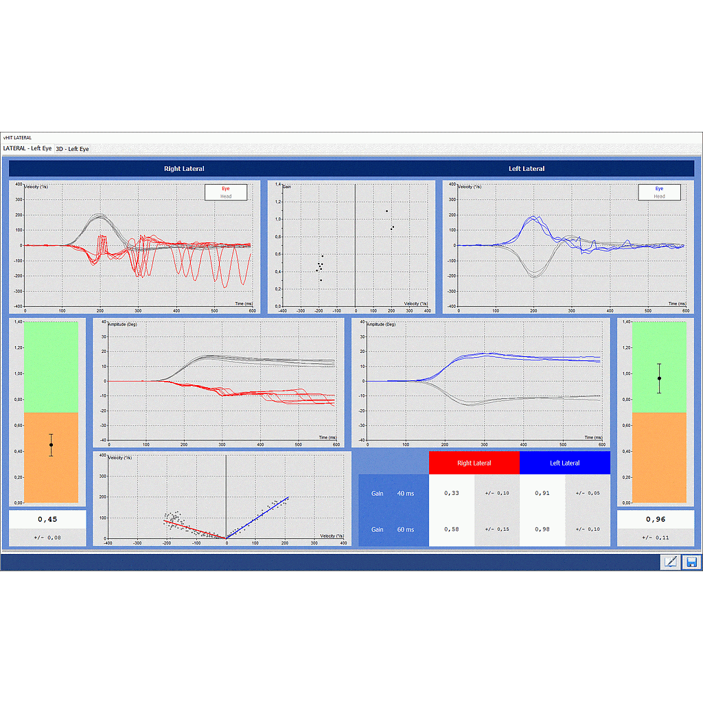 DI 14050X-VHIT : Option for Headstar Video Head Impulse Test