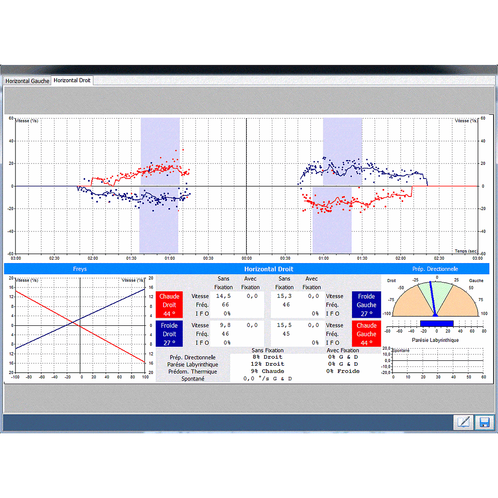 DI 14050X-BASIC : Module for NysStar and Headstar