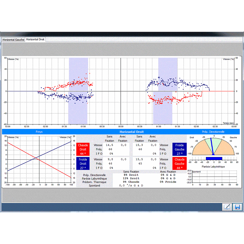 DI 14050X-BASIC : Nystagmography software Disoft II PRO Line : Basic Module