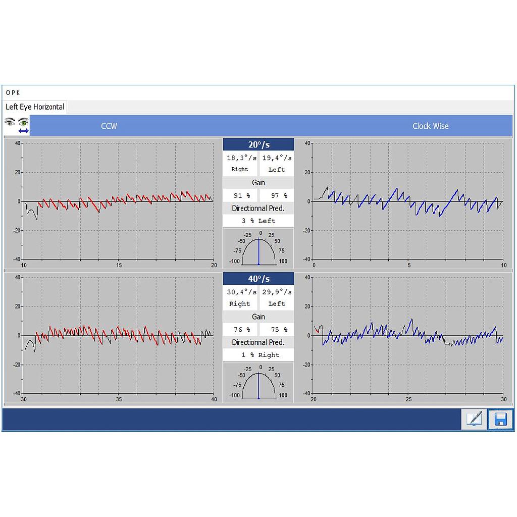 Nystagmography software Disoft II PRO Line : Oculography