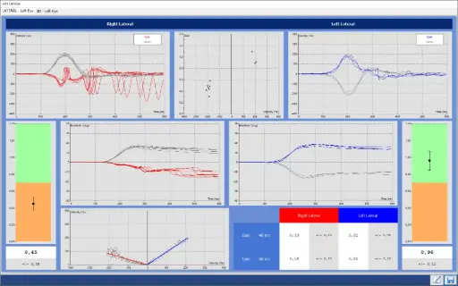 [00020678] DI 14050X-VHITL : Nystagmography software Disoft II PRO Line : VHIT Lateral Only