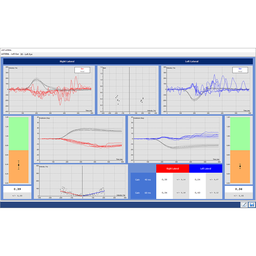 [00021333] Option for Headstar Video Head Impulse Test, on 6 semi-circular channels (Lateral, LARP, RALP) at 250Hz